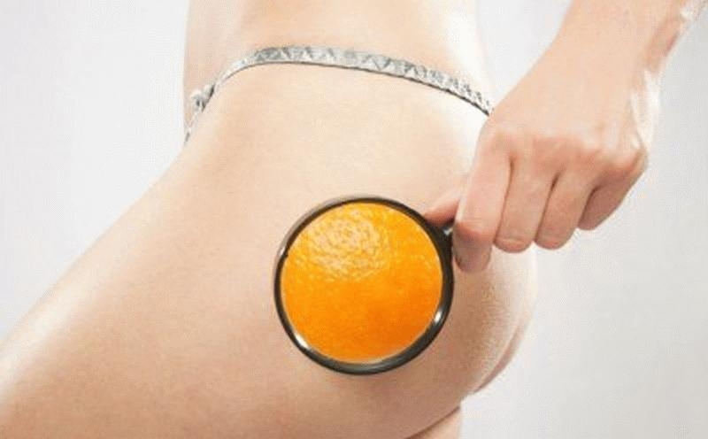 How to beat cellulite in 3 steps